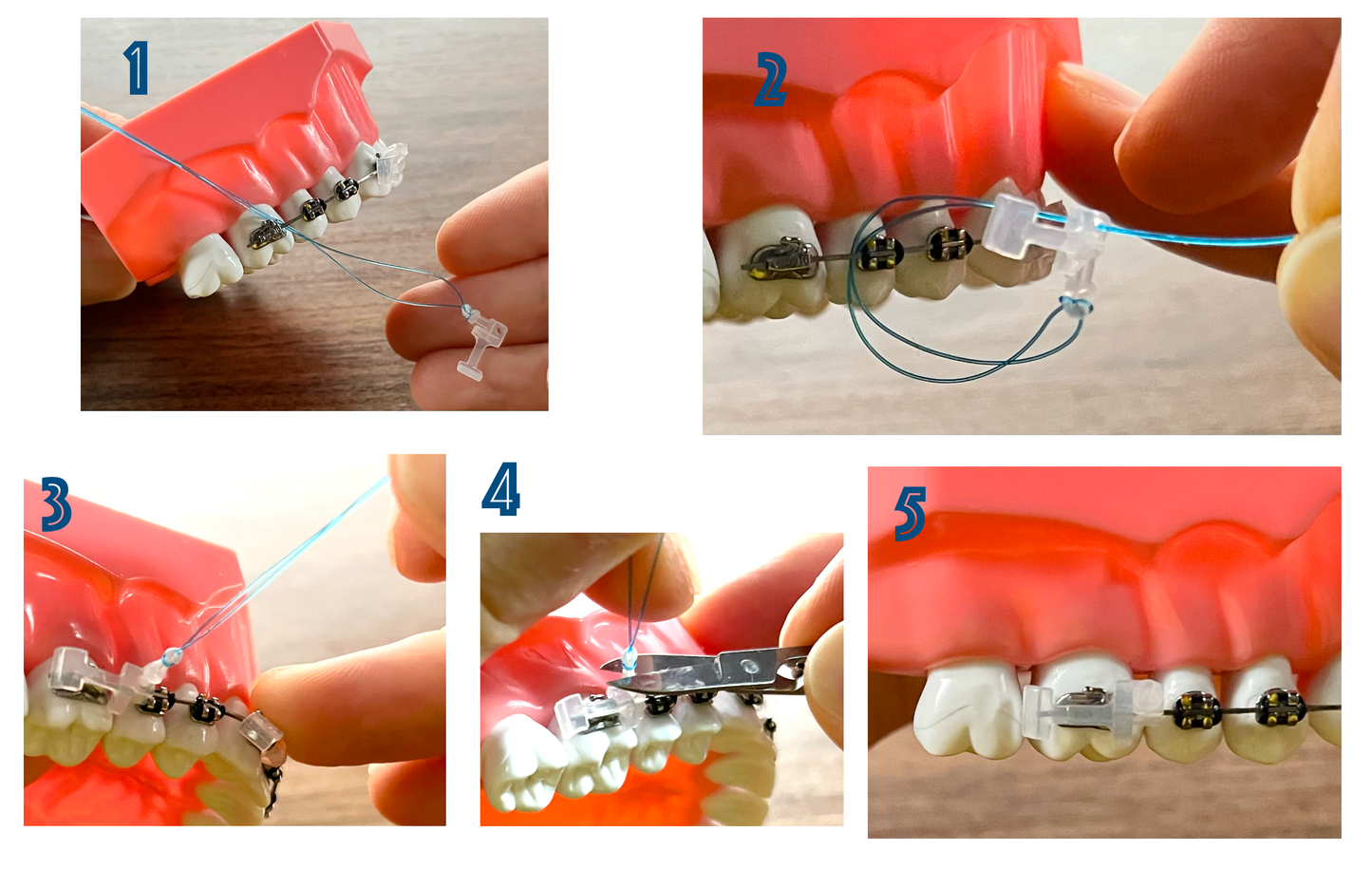 Brace Bumper - Two pack