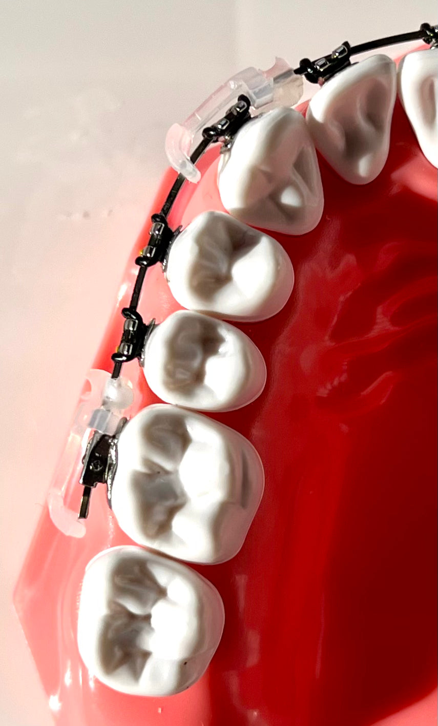 Brace Bumper - Two pack